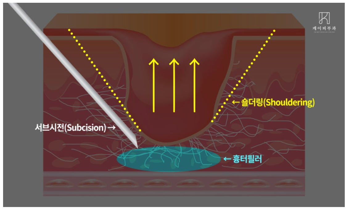 스크린샷 2025-06-14 111126.png
