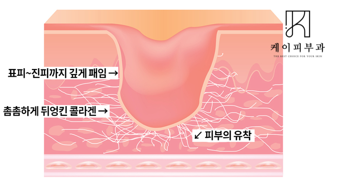 스크린샷 2025-06-14 111104.png