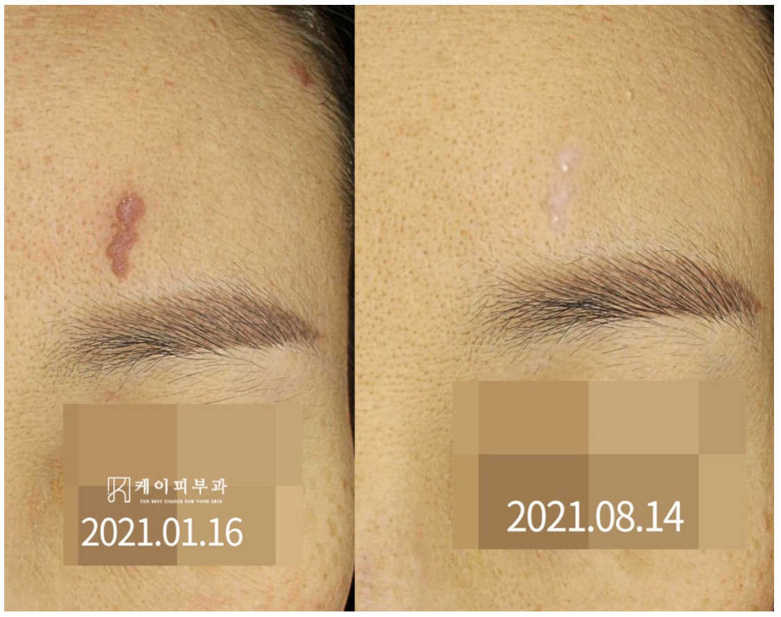 스크린샷 2025-06-14 111149.png