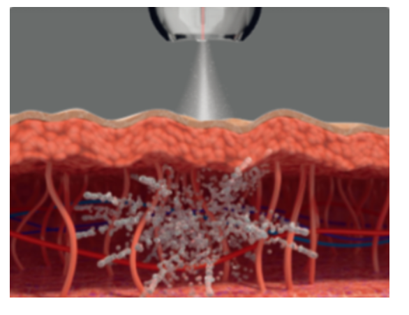 스크린샷 2025-06-14 111724.png