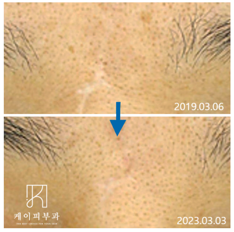 스크린샷 2025-06-14 111522.png