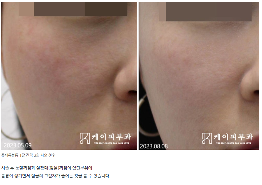 스크린샷 2025-06-14 112347.png