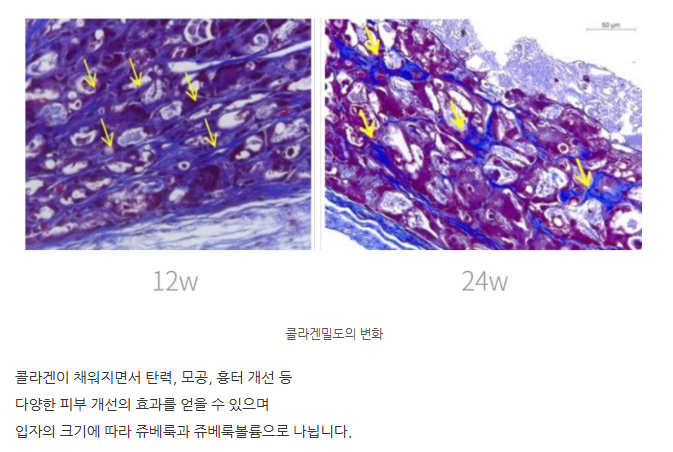 스크린샷 2025-06-14 112314.png