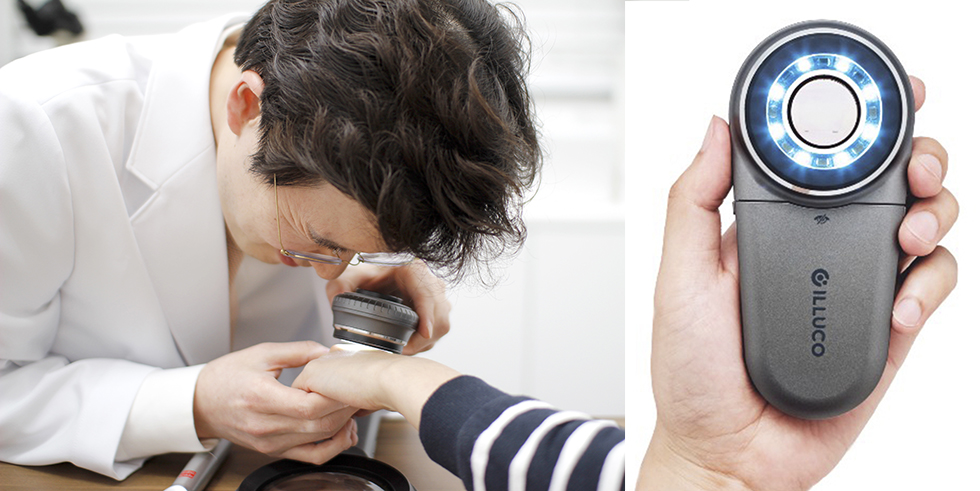 부산 눈썹문신제거_09.jpg