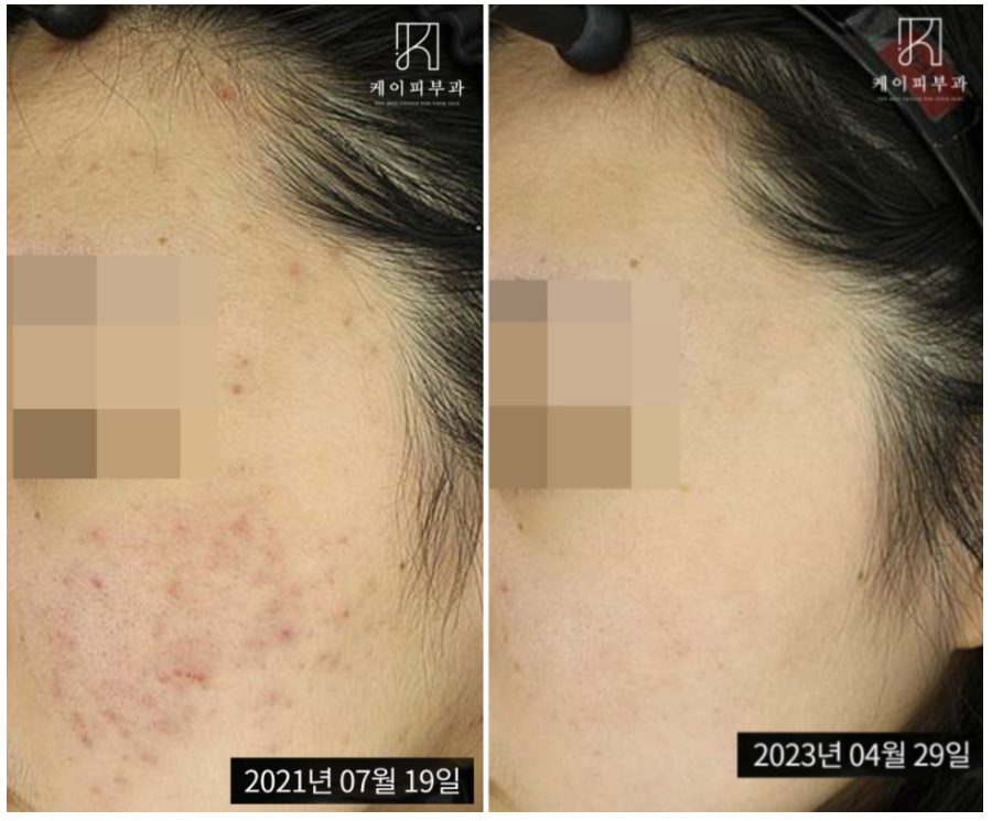 스크린샷 2025-06-14 112844.png