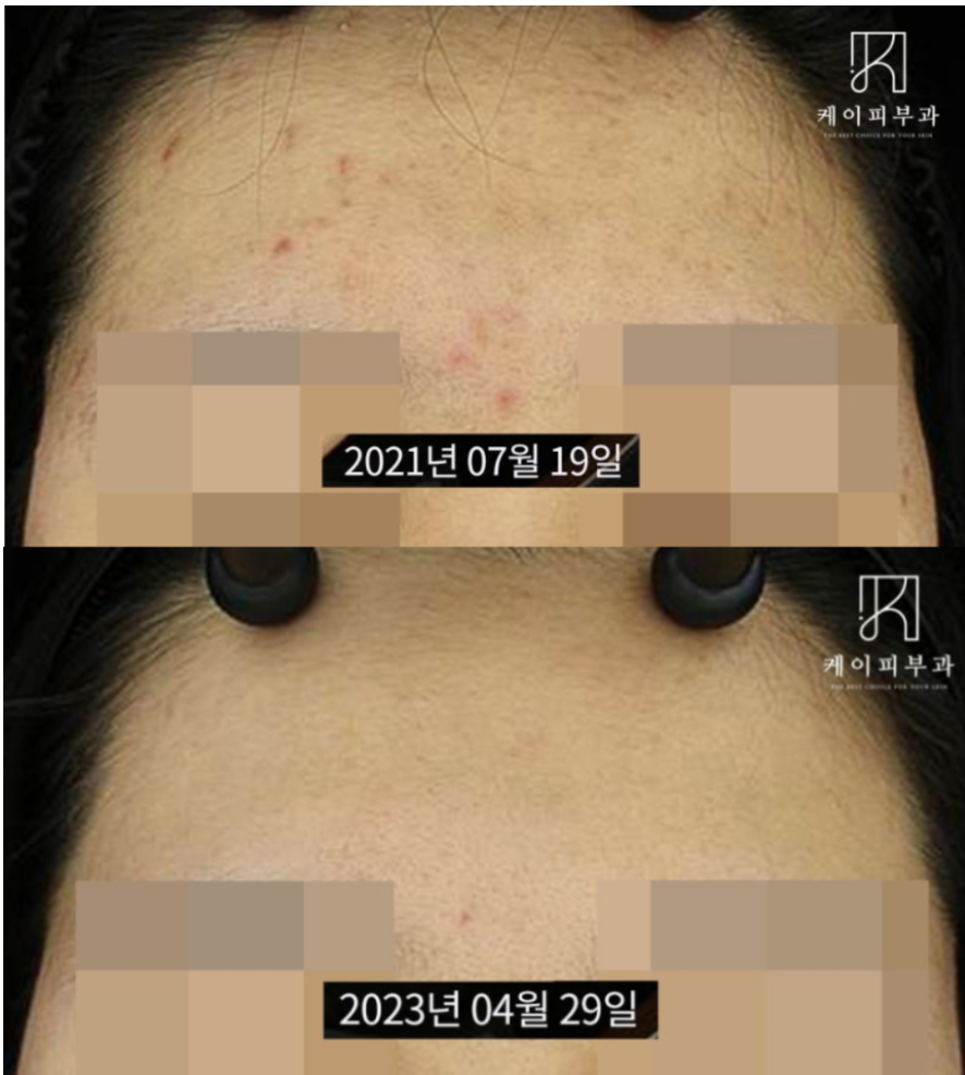 스크린샷 2025-06-14 112828.png