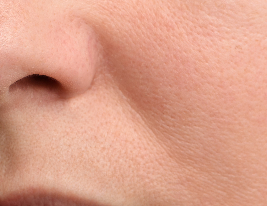 부산 팔자주름 리프팅 레이저_03.jpg