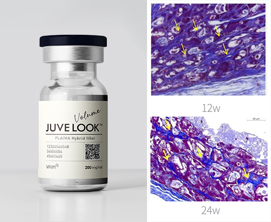 부산 팔자주름 리프팅 레이저_08.jpg