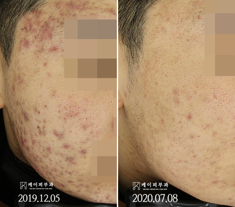 스크린샷 2025-06-23 170134.png