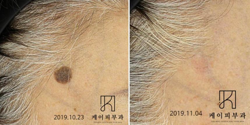 스크린샷 2025-06-23 170532.png