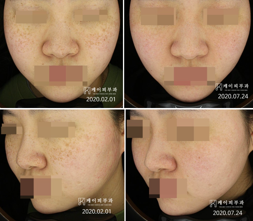 스크린샷 2025-06-23 170755.png