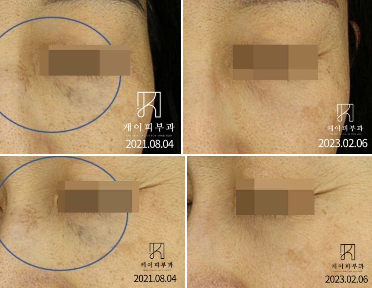 스크린샷 2025-06-24 181515.png