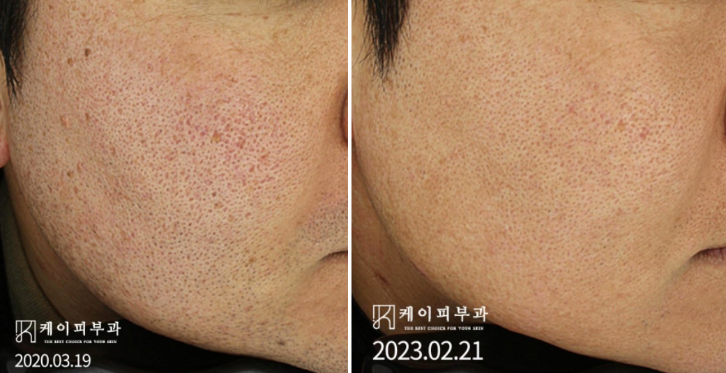 스크린샷 2025-06-24 182323.png