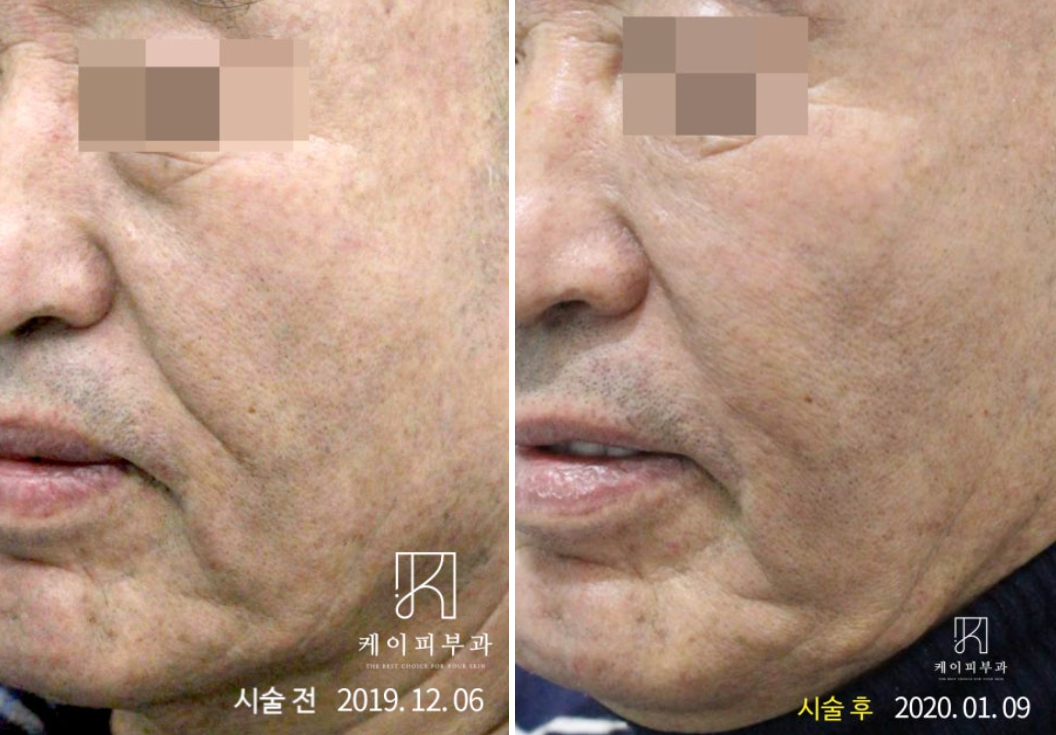 스크린샷 2025-06-25 171939.png