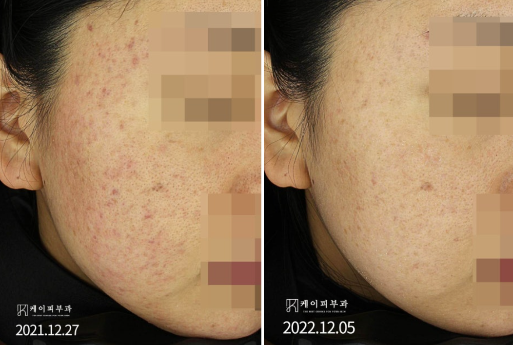 스크린샷 2025-06-25 172221.png