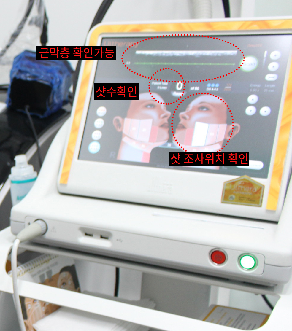 울쎄라 리프팅_02.jpg