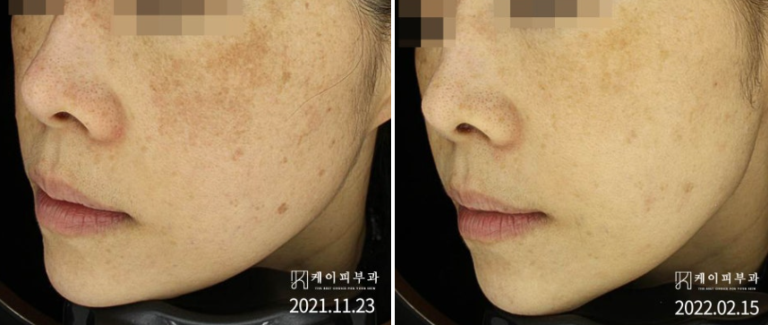 스크린샷 2025-07-14 160229.png